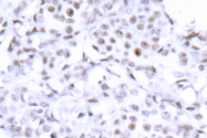 AP06318PU-N - SMC1A / SMC1