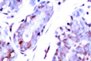AP06325PU-N - STAT1