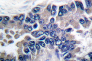 AP06326PU-N - STAT2