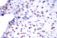 AP06327PU-N - STAT3