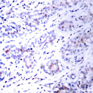 AP06328PU-N - STAT3