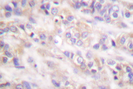 AP06335PU-N - SYK
