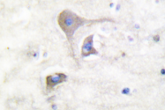 AP06337PU-N - Beta-Synuclein / SCNB