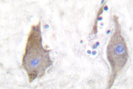 AP06338PU-N - Synuclein
