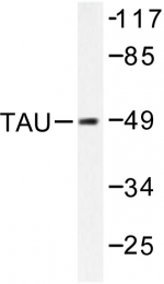 AP06342PU-N - MAPT / TAU