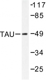 AP06347PU-N - MAPT / TAU