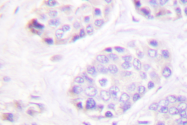AP06352PU-N - TGF-beta-3 (TGFB3)