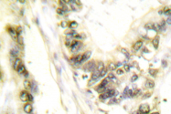 AP06353PU-N - THRA / ERBA1
