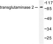 AP06356PU-N - Transglutaminase-2 (TGM2)
