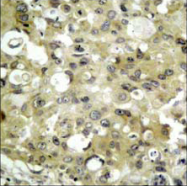 AP06360PU-N - CD309 / VEGFR-2 / Flk-1