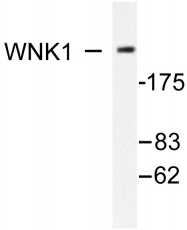 AP06363PU-N - WNK1