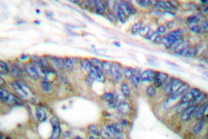 AP06364PU-N - EIF4EBP1 / 4E-BP1