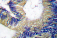 AP06365PU-N - EIF4EBP1 / 4E-BP1