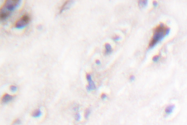 AP06370PU-N - Amylin / IAPP
