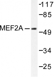 AP06372PU-N - MEF2A