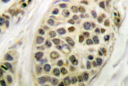 AP06372PU-N - MEF2A