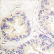 AP06377PU-N - Caspase-9