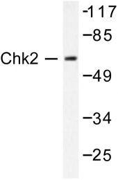 AP06380PU-N - CHK2