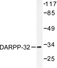 AP06383PU-N - DARPP32