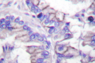 AP06389PU-N - GAD1 / GAD67