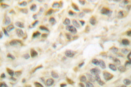 AP06391PU-N - GSK3 beta
