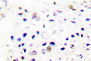 AP06393PU-N - HDAC5