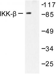 AP06396PU-N - IKBKB / IKKB