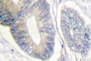 AP06411PU-N - SHC1 / SHC