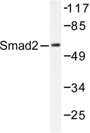 AP06413PU-N - SMAD2