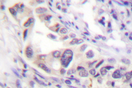 AP06413PU-N - SMAD2