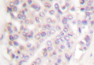 AP06414PU-N - SMAD3