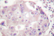 AP06415PU-N - STAT4