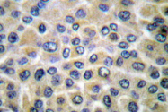 AP06416PU-N - SYK