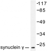 AP06417PU-N - Gamma-Synuclein / SNCG
