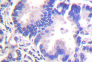 AP06417PU-N - Gamma-Synuclein / SNCG