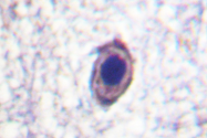 AP06418PU-N - TrkA