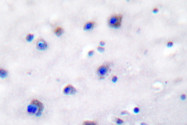 AP06419PU-N - TrkB