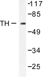 AP06420PU-N - Tyrosine 3-monooxygenase (TH)