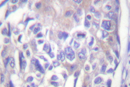 AP06423PU-N - Alpha-Adducin / ADD1
