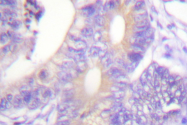 AP06426PU-N - CBL / RNF55
