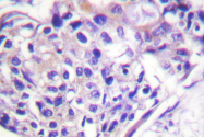AP06429PU-N - FOXO1/3/4-pan