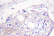 AP06430PU-N - Beta-ARK-1 / ADRBK1