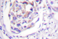 AP06432PU-N - IRS1