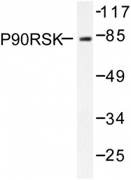AP06435PU-N - RPS6KA1