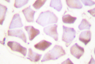 AP06440PU-N - Cardiac Troponin I