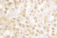 AP06443PU-N - NKX3-1