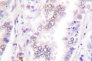 AP06446PU-N - CDK7
