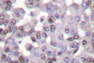AP06449PU-N - NCOR1