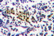 AP06451PU-N - NUB1