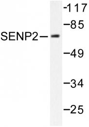 AP06457PU-N - SENP2